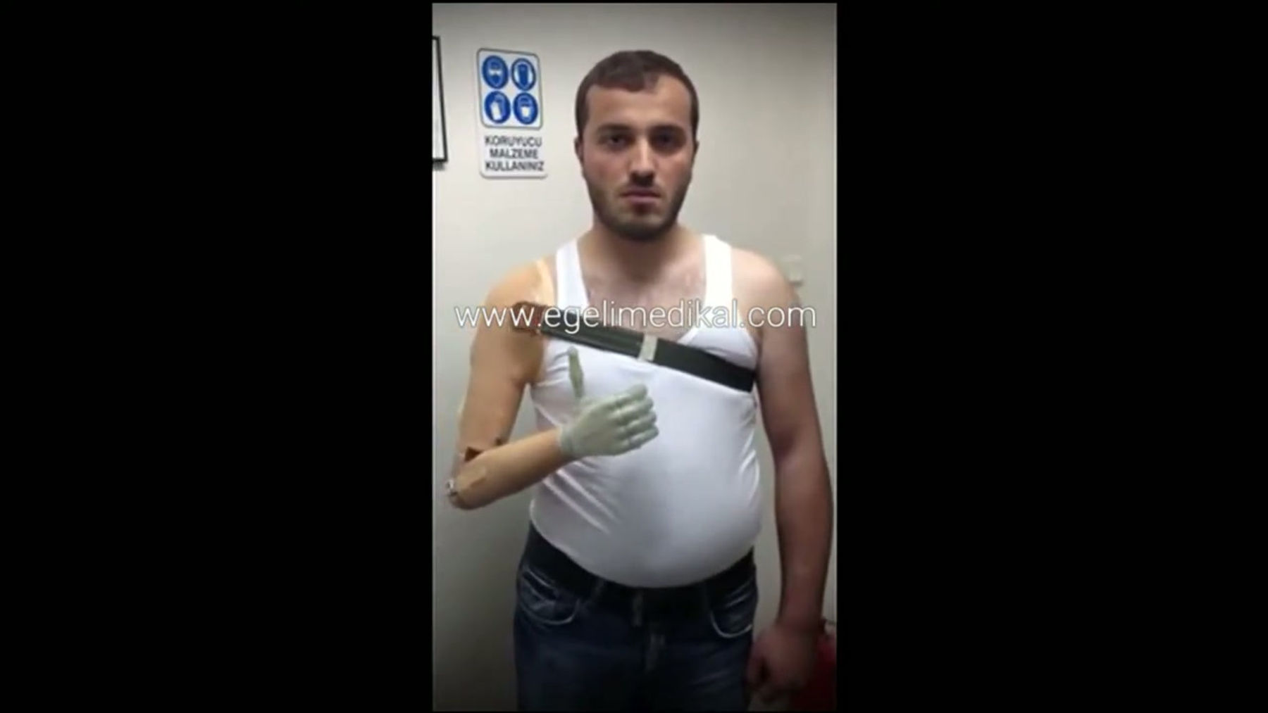 Össur Touch Bionics Biyonik Kol Protezi